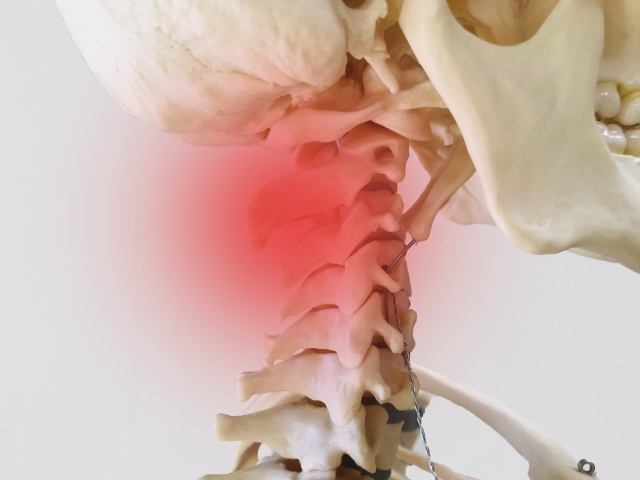 首コリの原因となる筋肉の解説